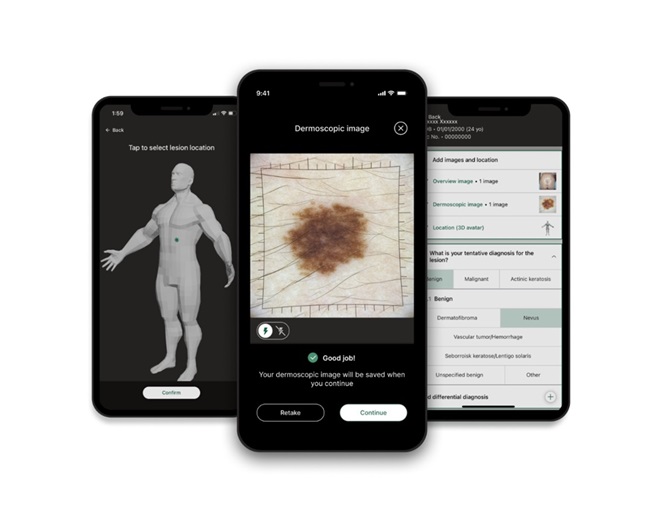 Dermloop screens