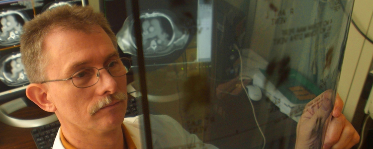 Dr. James Gossage, director of the 肺血管疾病 program, examines chest x-ray