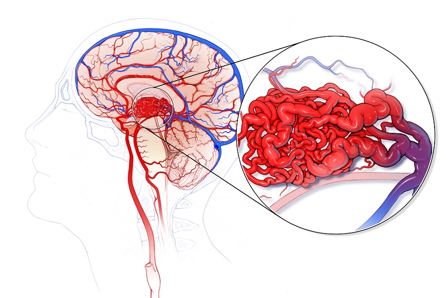 brain
