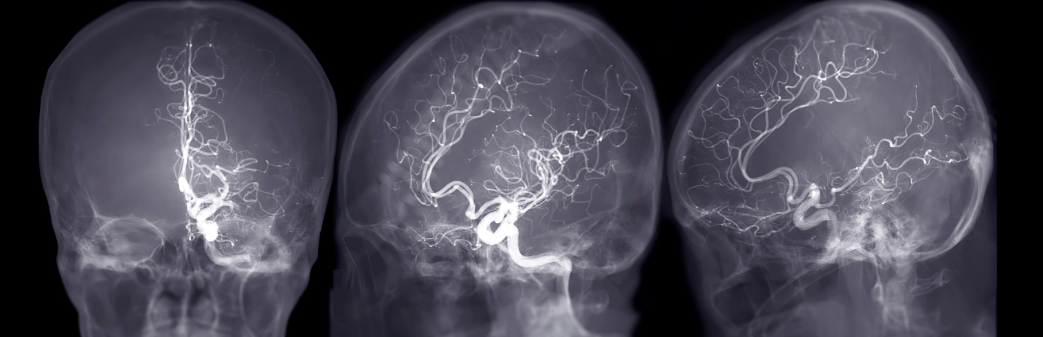 image of brain neurons