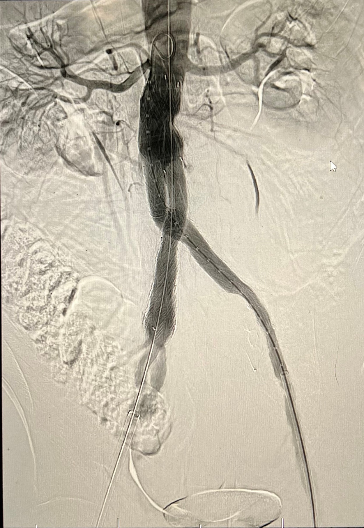 vascular picture